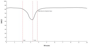 Utilization Weakness Curve
